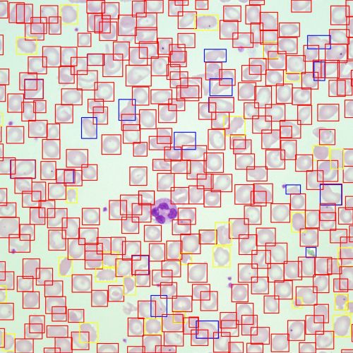 Screenshot KI-Zellerkennung
